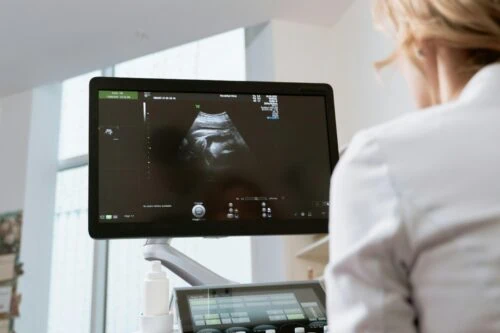 Find Ultrasound Tech Jobs with Hospitals Hiring Now